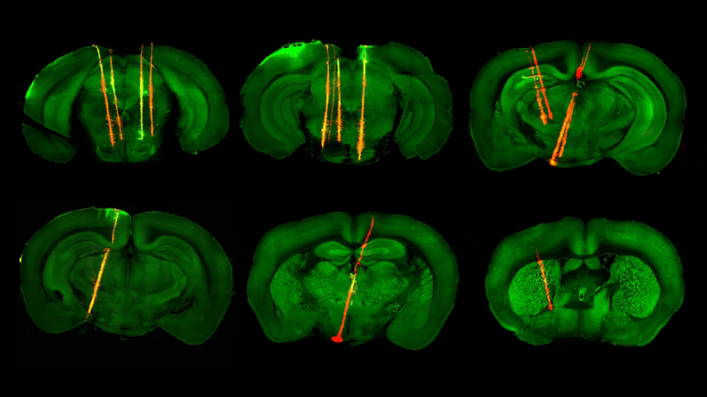 IBL_neuropixels